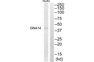 Western blot analysis of extracts from HuvEc cells, using GNA14 antibody. (GNa14 Antikörper  (N-Term))