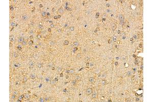 ABIN6258206 and ABIN6274351 at 1/100 staining Rat brain tissue by IHC-P. (GIT2 Antikörper  (Internal Region))