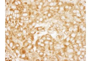 Immunohistochemistry (IHC) image for anti-Ribosomal Protein L7 (RPL7) (C-Term) antibody (ABIN7449014) (RPL7 Antikörper  (C-Term))