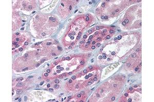 Immunohistochemistry (IHC) image for anti-Insulin-Like Growth Factor 2 mRNA Binding Protein 1 (IGF2BP1) (AA 155-204) antibody (ABIN6736731)