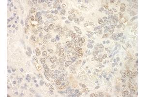Immunohistochemistry (IHC) image for anti-Nuclear Cap Binding Protein Subunit 2 (NCBP2) (AA 106-156) antibody (ABIN7448682) (NCBP2 Antikörper  (AA 106-156))