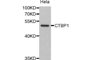 Western blot analysis of extracts of HeLa cells, using CTBP1 antibody (ABIN1872058). (CTBP1 Antikörper)