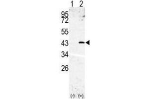 Western blot analysis of SPPL3(arrow) using rabbit polyclonal SPPL3 Antibody (SPPL3 Antikörper  (N-Term))