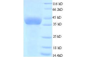 Glyceraldehyde-3-Phosphate Dehydrogenase (GAPDH) (AA 2-333) protein (His tag) expressed in E. (GAPDH Protein (AA 2-333) (His tag))