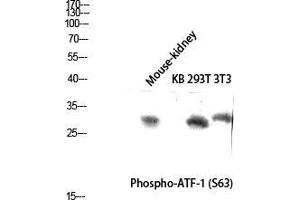 Western Blot (WB) analysis of Mouse Kidney KB 293T 3T3 lysis using Phospho-ATF-1 (S63) antibody.