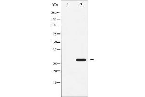Western blot analysis of ATF1 expression in COLO205 whole cell lysates,The lane on the left is treated with the antigen-specific peptide.