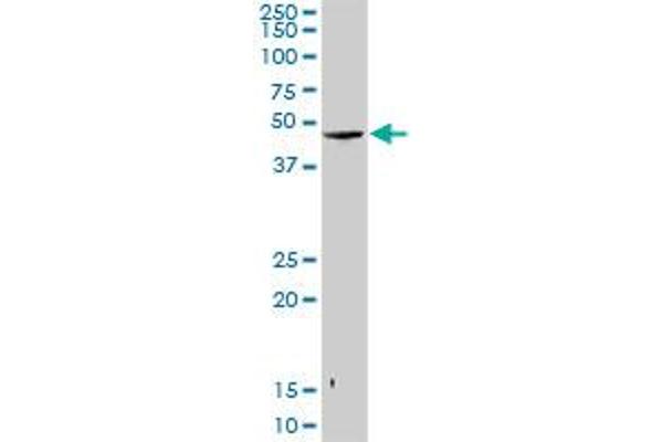 Snurportin 1 Antikörper  (AA 1-360)