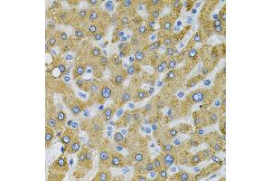 Immunohistochemistry of paraffin-embedded human liver injury using SDC4 Antibody (ABIN5970935) at dilution of 1/100 (40x lens). (SDC4 Antikörper)