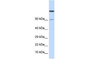 Western Blot showing ZNF251 antibody used at a concentration of 1-2 ug/ml to detect its target protein. (ZNF251 Antikörper  (Middle Region))