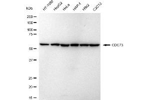 Western blotting analysis using CDC73 antibody (ABIN7799734).