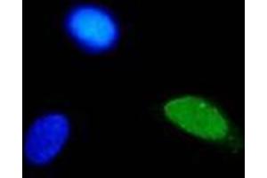 Immunofluorescence (IF) image for anti-Human Papilloma Virus Type 11 (HPV-11) (AA 83-201) antibody (ABIN781774) (Human Papilloma Virus Type 11 (HPV-11) (AA 83-201) Antikörper)