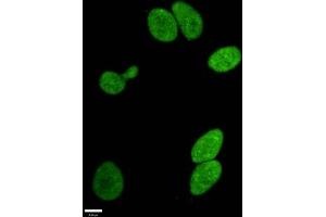 Immunofluorescence staining of Hela cells withABIN7127303 at 1:96,counter-stained with DAPI. (Rekombinanter HIST1H3A Antikörper  (H3R17me))