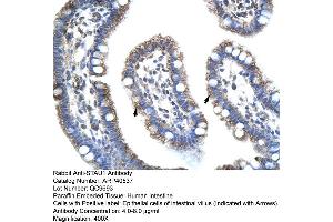 Rabbit Anti-STAU1 Antibody  Paraffin Embedded Tissue: Human Intestine Cellular Data: Epithelial cells of intestinal villas Antibody Concentration: 4. (STAU1/Staufen Antikörper  (N-Term))