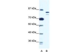 Western Blotting (WB) image for anti-Minichromosome Maintenance Deficient 8 (MCM8) antibody (ABIN2461402) (MCM8 Antikörper)