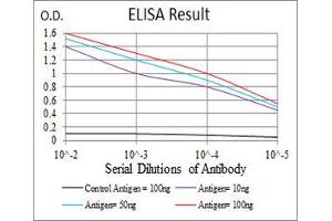 Black line: Control Antigen (100 ng), Purple line: Antigen(10 ng), Blue line: Antigen (50 ng), Red line: Antigen (100 ng), (LDLR Antikörper  (AA 22-150))