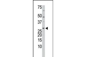 Antibody is used in Western blot to detect TrxL in HL-60 cell lysate.