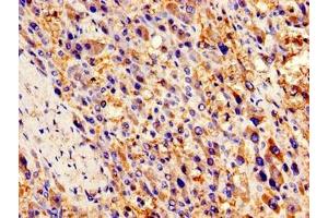 Immunohistochemistry (IHC) image for anti-Chemokine (C-C Motif) Ligand 2 (CCL2) (AA 24-99) antibody (ABIN7145972)