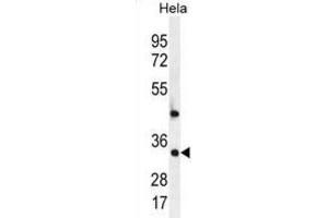 Western Blotting (WB) image for anti-Mediator Complex Subunit 7 (MED7) antibody (ABIN2996463) (MED7 Antikörper)