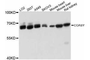 Western blot analysis of extracts of various cell lines, using COASY antibody (ABIN6291955) at 1:3000 dilution. (COASY Antikörper)