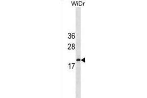 Western Blotting (WB) image for anti-Interferon, alpha 5 (IFNA5) antibody (ABIN3000243) (IFNA5 Antikörper)