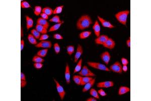 IF analysis of GIGYF2 using anti-GIGYF2 antibody (ABIN7601679).