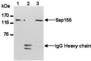 Western Blotting (WB) image for anti-Splicing Factor 3b, Subunit 1, 155kDa (SF3B1) (AA 98-198) antibody (ABIN1449241) (SF3B1 Antikörper  (AA 98-198))