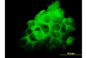 Immunofluorescence (IF) image for anti-Fibronectin Type III Domain Containing 3A (FNDC3A) (AA 1012-1110) antibody (ABIN524813)