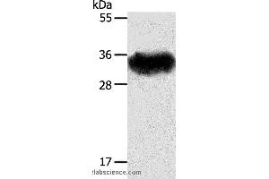 Western blot analysis of Mouse brain tissue, using STX1A Polyclonal Antibody at dilution of 1:600 (STX1A Antikörper)