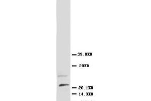 Anti-NGF antibody, Western blotting WB: Rat Brain Tissue Lysate (Nerve Growth Factor Antikörper  (N-Term))