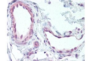 Immunohistochemistry (IHC) image for anti-Endothelin Receptor Type B (EDNRB) (C-Term) antibody (ABIN1048560)