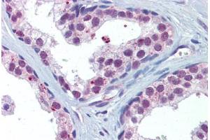 Prostate, Human: Formalin-Fixed, Paraffin-Embedded (FFPE) (AKT1/2 Antikörper)