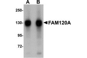 Western Blotting (WB) image for anti-Family with Sequence Similarity 120A (FAM120A) (Middle Region) antibody (ABIN1030930) (FAM120A Antikörper  (Middle Region))