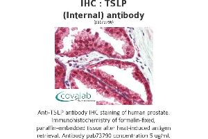 Image no. 3 for anti-Thymic Stromal Lymphopoietin (TSLP) (Internal Region) antibody (ABIN1740422) (Thymic Stromal Lymphopoietin Antikörper  (Internal Region))