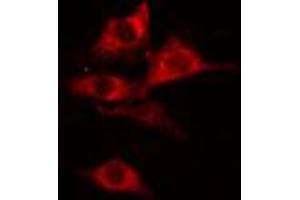 ABIN6274775 staining COLO205 cells by IF/ICC. (RPL27A Antikörper  (C-Term))