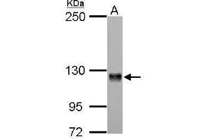 WB Image Amphiphysin antibody [N1N2], N-term detects AMPH protein by Western blot analysis. (Amphiphysin Antikörper  (N-Term))