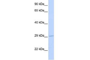 WB Suggested Anti-SLC25A6 Antibody Titration: 0. (SLC25A6 Antikörper  (N-Term))