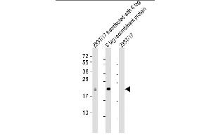 All lanes : Anti-S1 tag Antibody Antibody at 1:2000 dilution Lane 1: 293T/17 transfected with 6 tag lysate Lane 2: 6 tag recombinant protein lysate Lane 3: 293T/17 whole cell lysate Lysates/proteins at 20 μg per lane. (S1-Tag Antikörper)
