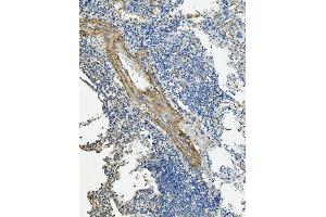 IHC analysis of VCL using anti-VCL antibody (ABIN7599003).