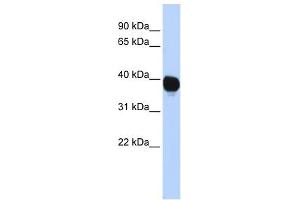 TPST2 antibody used at 1 ug/ml to detect target protein. (TPST2 Antikörper  (Middle Region))
