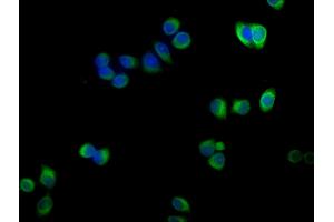 Immunofluorescence staining of PC-3 cells with ABIN7143116 at 1:100,counter-stained with DAPI. (ACTRT1 Antikörper  (AA 201-376))