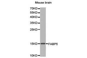 Western Blotting (WB) image for anti-Fatty Acid Binding Protein 5 (Psoriasis-Associated) (FABP5) antibody (ABIN1872637)