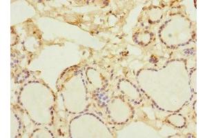 Immunohistochemistry (IHC) image for anti-Nuclear Factor of kappa Light Polypeptide Gene Enhancer in B-Cells Inhibitor, epsilon (NFKBIE) (AA 140-280) antibody (ABIN7161528)