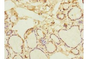 Immunohistochemistry of paraffin-embedded human thyroid tissue using ABIN7161528 at dilution of 1:100 (NFKBIE Antikörper  (AA 140-280))