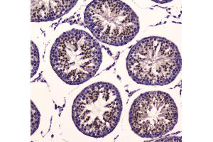 IHC analysis of PDK1 using anti-PDK1 antibody . (PDPK1 Antikörper  (AA 107-336))