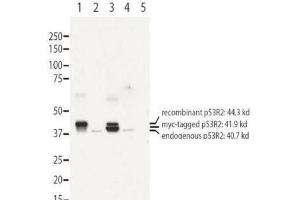 Western blot using  affinity purified anti-RRM2B antibody shows detection of recombinant (lanes 1 and 3) and endogenous protein (lanes 1 to 4) in whole cell extracts from transfected 293T. (RRM2B Antikörper  (N-Term))
