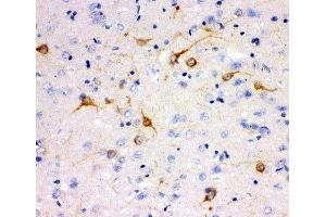 Immunohistochemistry (IHC) image for anti-Inositol 1,4,5-Trisphosphate Receptor, Type 3 (ITPR3) (AA 2411-2758) antibody (ABIN3031328)