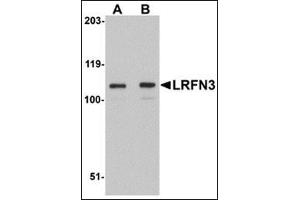 Western Blotting (WB) image for anti-Leucine Rich Repeat and Fibronectin Type III Domain Containing 3 (LRFN3) (Center) antibody (ABIN500190)