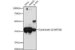Western blot analysis of extracts of various cell lines, using Cytokeratin 18 (KRT18) Rabbit mAb (ABIN7268097) at 1:1000 dilution. (Cytokeratin 18 Antikörper)