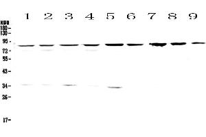 Western blot analysis of CD2AP using anti-CD2AP antibody . (CD2AP Antikörper  (AA 253-337))