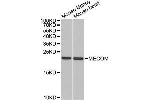 Western blot analysis of extracts of various cell lines, using MECOM antibody. (MECOM Antikörper)